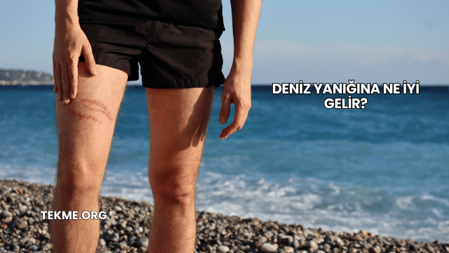 Deniz Yanığına Ne İyi Gelir?