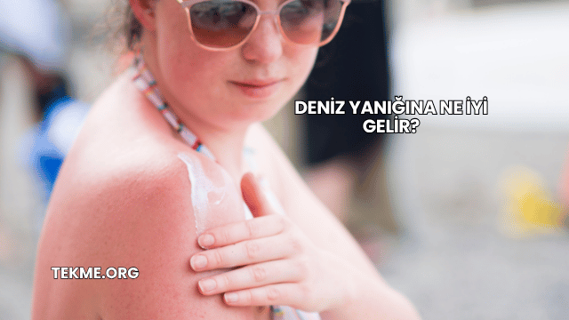 Deniz Yanığına Ne İyi Gelir?
