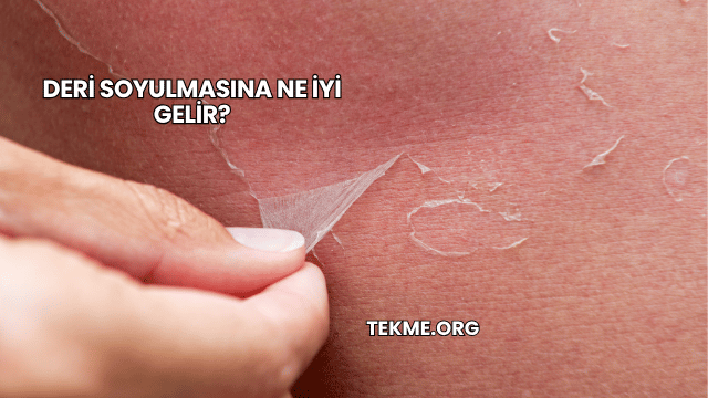 Deri Soyulmasına Ne İyi Gelir?