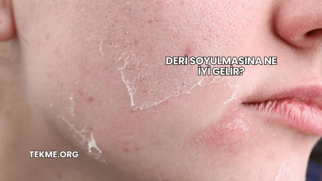 Deri Soyulmasına Ne İyi Gelir?