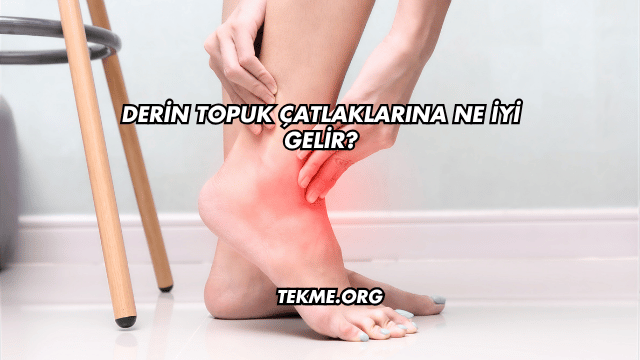 Derin Topuk Çatlaklarına Ne İyi Gelir?