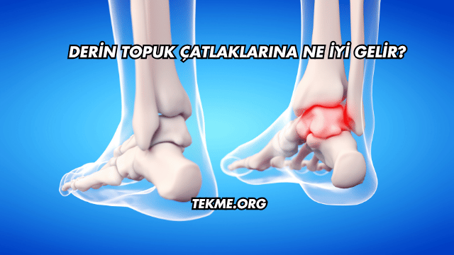 Derin Topuk Çatlaklarına Ne İyi Gelir?