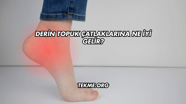 Derin Topuk Çatlaklarına Ne İyi Gelir?