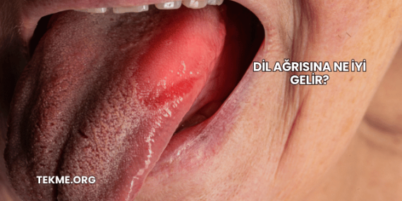 Dil Ağrısına Ne İyi Gelir?