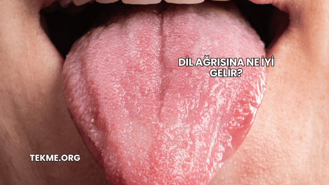 Dil Ağrısına Ne İyi Gelir?