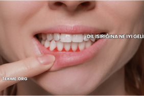 Dil Isırığına Ne İyi Gelir?