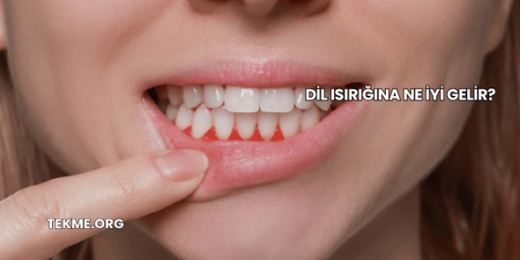 Dil Isırığına Ne İyi Gelir?