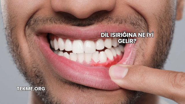 Dil Isırığına Ne İyi Gelir?