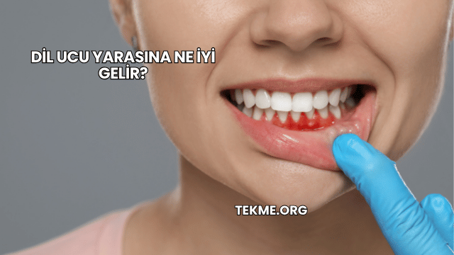 Dil Ucu Yarasına Ne İyi Gelir?