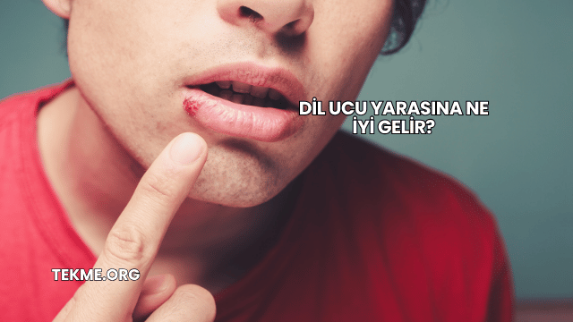 Dil Ucu Yarasına Ne İyi Gelir?