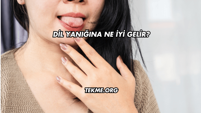 Dil Yanığına Ne İyi Gelir?