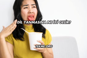 Dil Yanmasına Ne İyi Gelir?