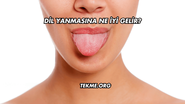 Dil Yanmasına Ne İyi Gelir?