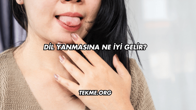 Dil Yanmasına Ne İyi Gelir?