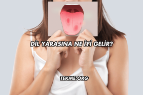 Dil Yarasına Ne İyi Gelir?