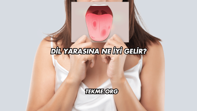 Dil Yarasına Ne İyi Gelir?