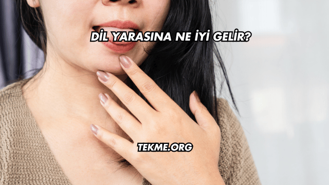 Dil Yarasına Ne İyi Gelir?
