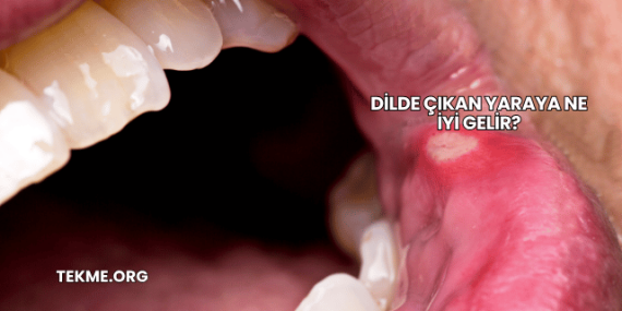 Dilde Çıkan Yaraya Ne İyi Gelir?