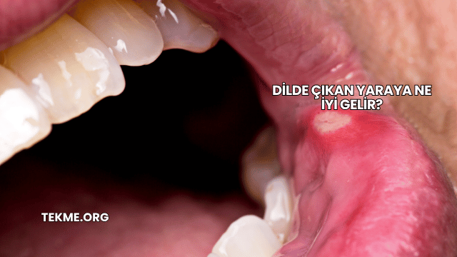 Dilde Çıkan Yaraya Ne İyi Gelir?