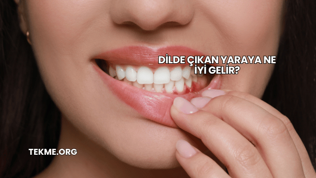 Dilde Çıkan Yaraya Ne İyi Gelir?