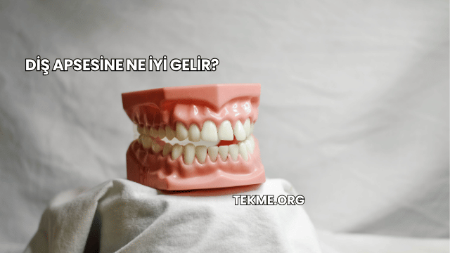 Diş Apsesine Ne İyi Gelir?