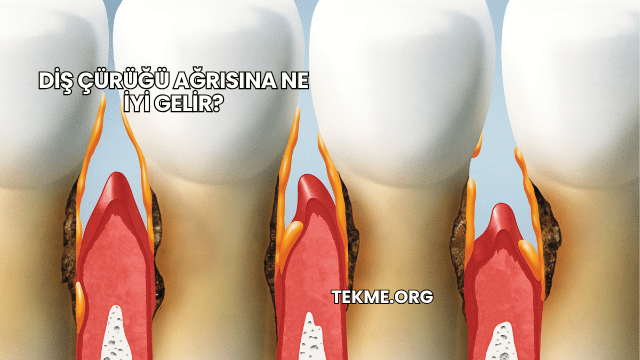 Diş Çürüğü Ağrısına Ne İyi Gelir?