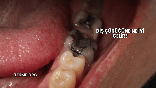 Diş Çürüğüne Ne İyi Gelir?