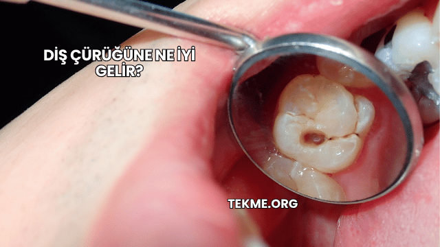 Diş Çürüğüne Ne İyi Gelir?