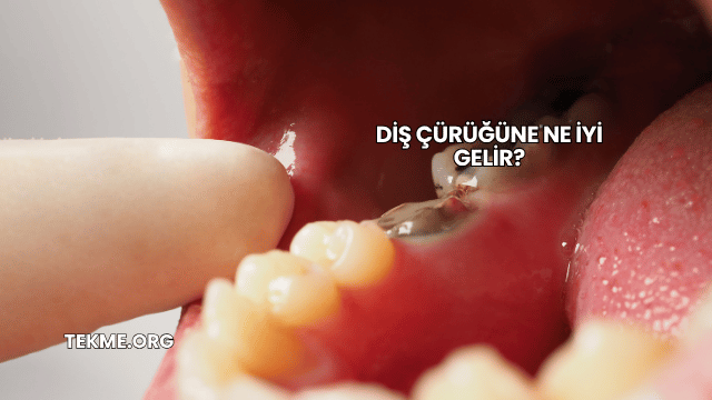 Diş Çürüğüne Ne İyi Gelir?