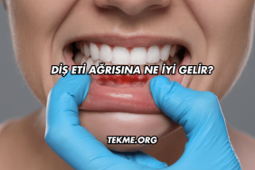 Diş Eti Ağrısına Ne İyi Gelir?