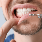 Diş Eti Apsesine Ne İyi Gelir?