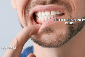 Diş Eti Apsesine Ne İyi Gelir?