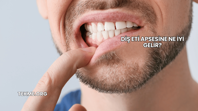 Diş Eti Apsesine Ne İyi Gelir?