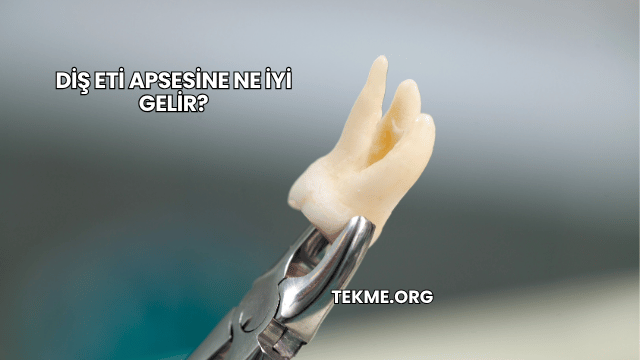 Diş Eti Apsesine Ne İyi Gelir?