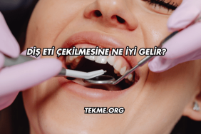 Diş Eti Çekilmesine Ne İyi Gelir?