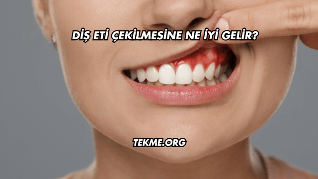 Diş Eti Çekilmesine Ne İyi Gelir?