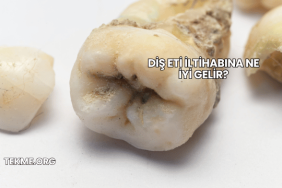 Diş Eti İltihabına Ne İyi Gelir?