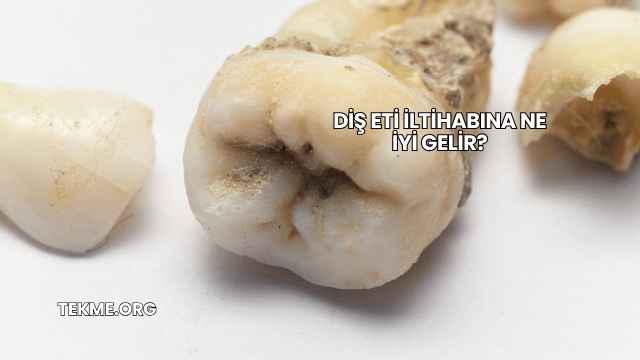 Diş Eti İltihabına Ne İyi Gelir?