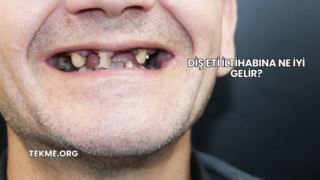 Diş Eti İltihabına Ne İyi Gelir?