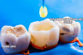 Diş Eti Kaşıntısına Ne İyi Gelir?