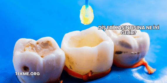 Diş Eti Kaşıntısına Ne İyi Gelir?