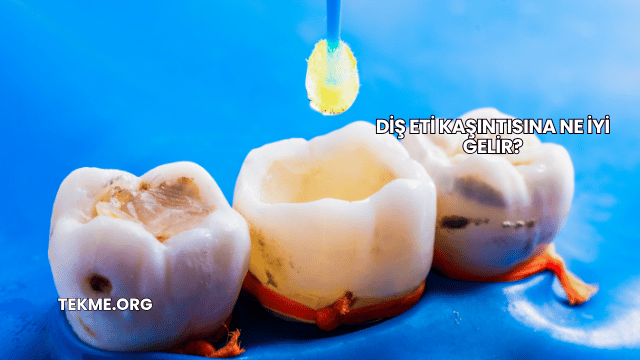 Diş Eti Kaşıntısına Ne İyi Gelir?