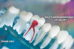 Diş Eti Morarmasına Ne İyi Gelir?
