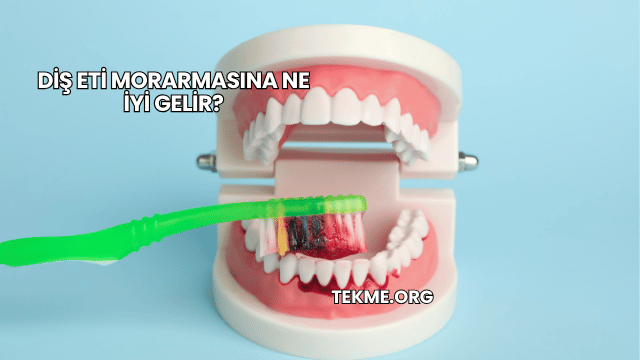 Diş Eti Morarmasına Ne İyi Gelir?