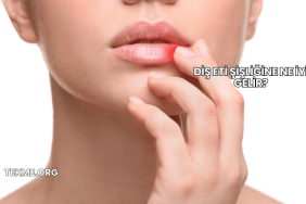 Diş Eti Şişliğine Ne İyi Gelir?