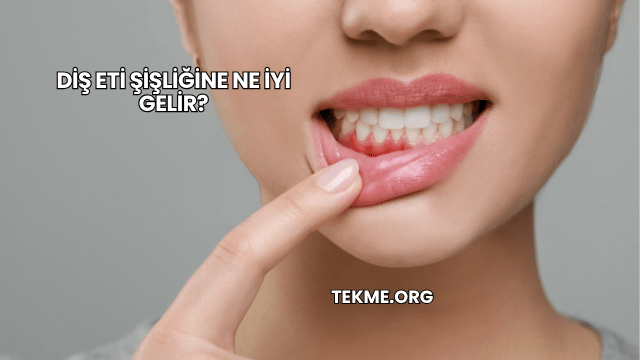 Diş Eti Şişliğine Ne İyi Gelir?