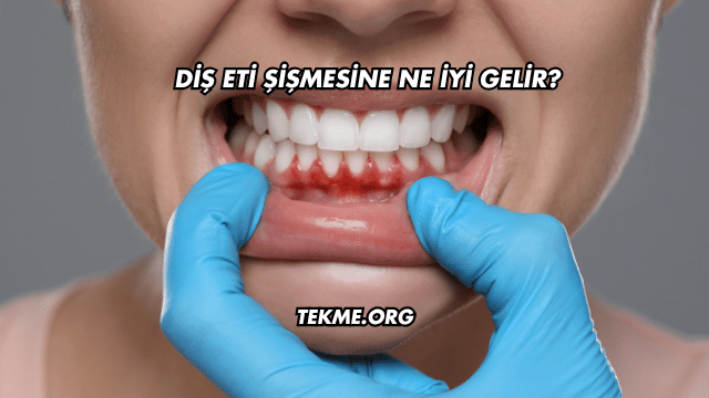 Diş Eti Şişmesine Ne İyi Gelir?