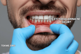 Diş Eti Yaralarına Ne İyi Gelir?