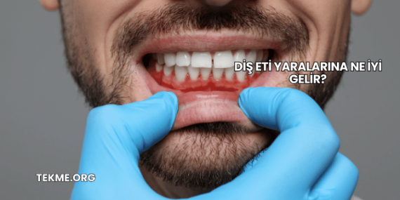 Diş Eti Yaralarına Ne İyi Gelir?