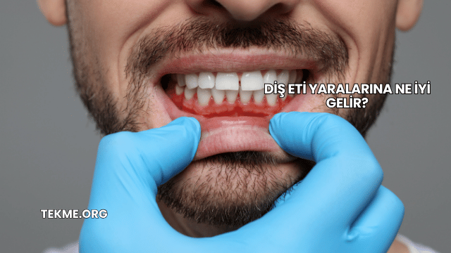 Diş Eti Yaralarına Ne İyi Gelir?